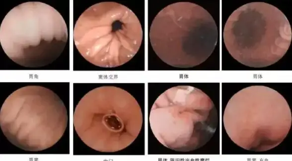 推荐热点｜一键部署无忧，玩转云服务器Facebook应用｜高效安全指南】